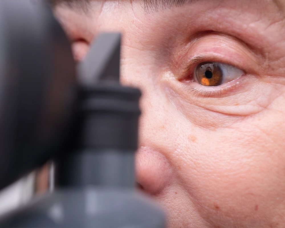 ottica centro oftalmico screening occhio secco